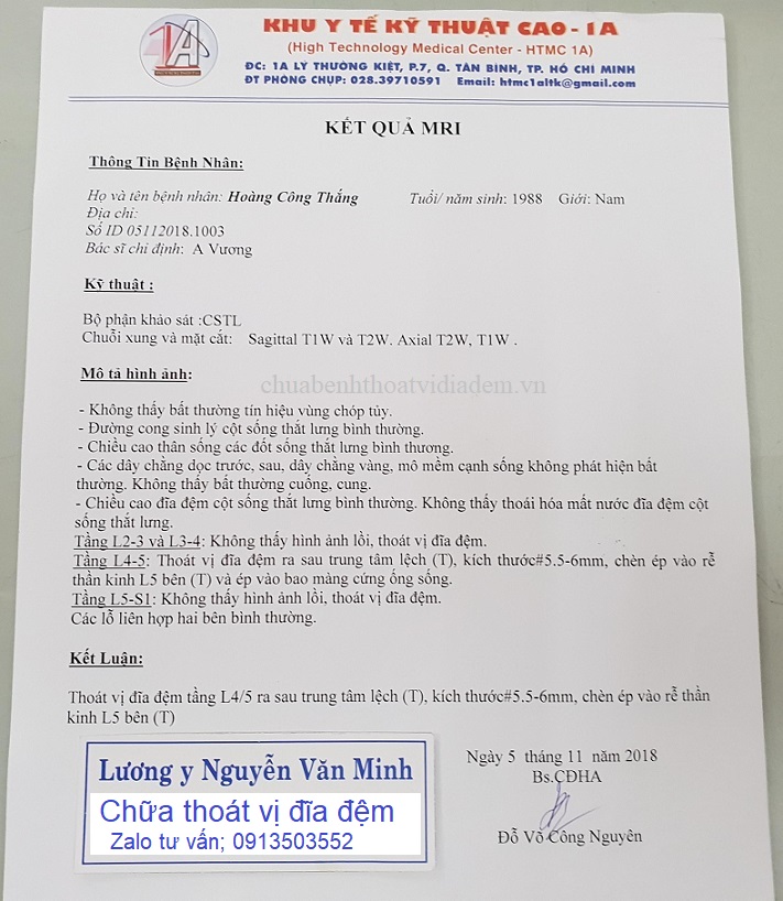 Thoát vị đĩa đệm L4-L5